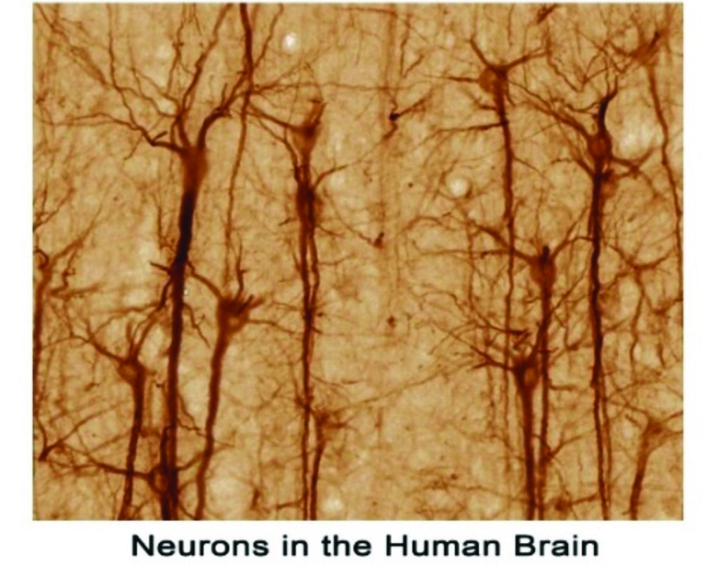 Fig. 2. Dettagli dei neuroni del cervelletto che lo fanno sembrare una foresta. Bentivoglio M. et alii (2019) Frontiers neuroanatomy. Foto di Camillo Golgi, rielaborata da Tiziana Cotrufo.